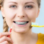 Braces Do's and Dont's