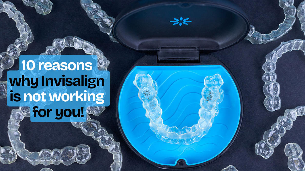 10 reasons while Invisalign is not working for you
