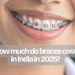 Braces cost in India