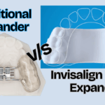 Invisalign Palatal Expander vs Traditional Expander: What Parents Should Know