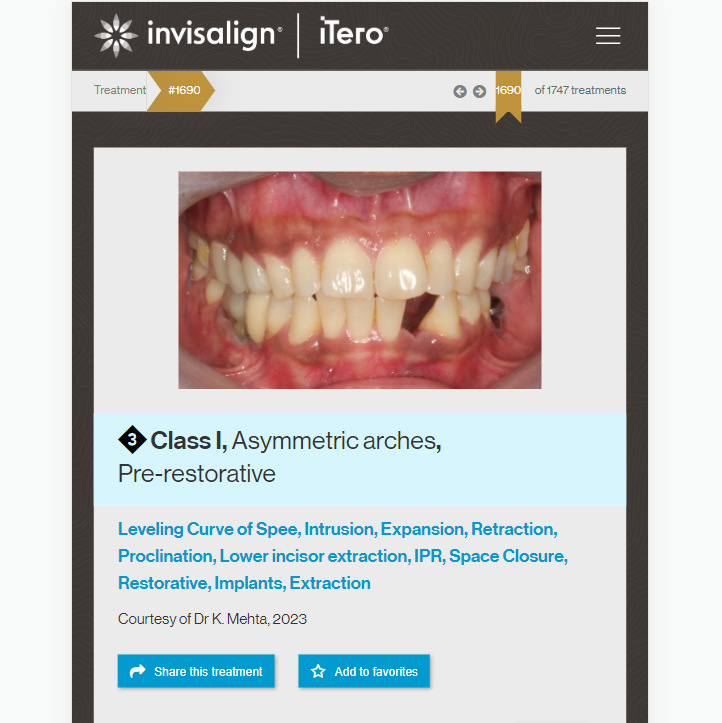 Invisalign in Chandigarh at Best Cost by Embrace Orthodontics